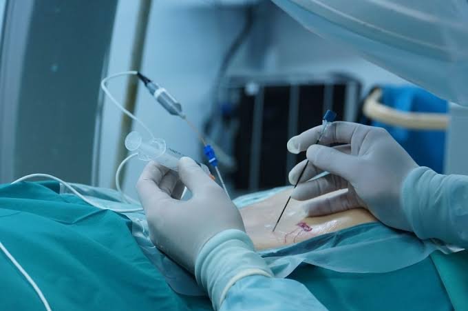 Hombre con dolor lumbar por hernia de disco