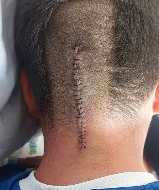 Persona con dolor lumbar