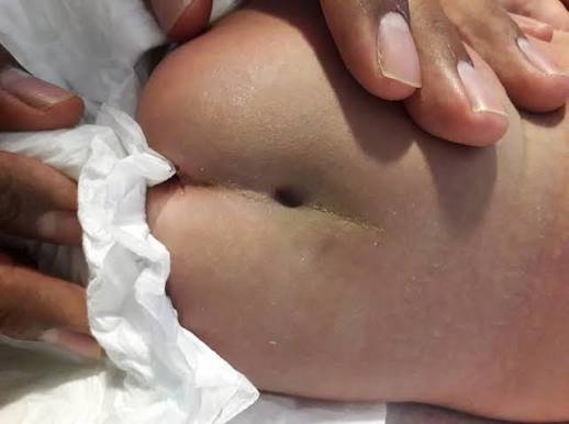 sintomas de tumores neurologicos pediatricos guadalajara