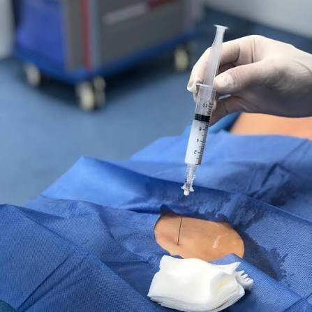Hombre con dolor lumbar por hernia de disco