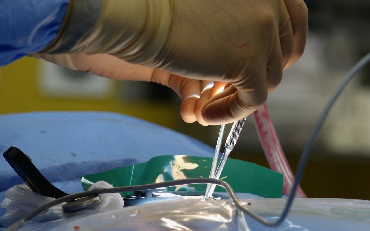 Cirugia vascular en guadalajara
